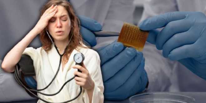 UNAM desarrolla un parche para tratar la hipertensión
