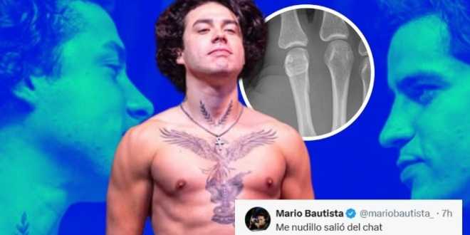Mario Bautista sufre fractura tras pelea contra Aaron