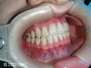 DRA EMMA CASTILLO. ODONTOLOGIA AVANZADA Y ORTODONCIA.