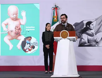 Presentan en La Mañanera la Unidad Nacional de Cirugía Fetal del hospital Rovirosa en Villahermosa